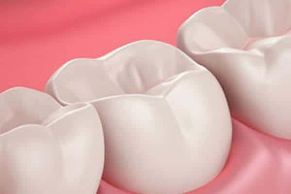 Dental model showing white tooth crowns on pink gum background for restorative dentistry.