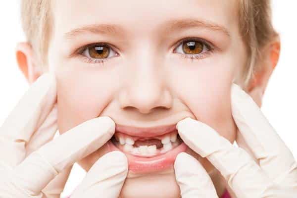 Young child pulling down lower lip to show teeth, demonstrating dental health or examination against white background.