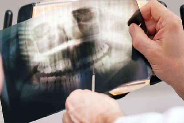 Dentist examining dental X-ray film against light source in clinical setting.