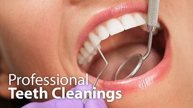 Professional Teeth Cleanings