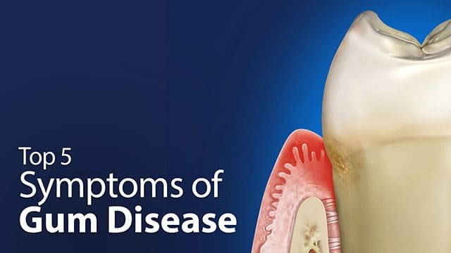 Top 5 Symptoms of Gum Disease