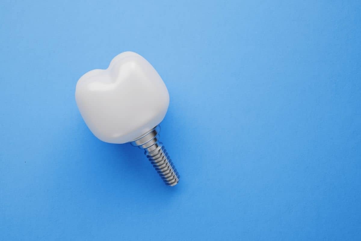 Dental Implants Fayetteville