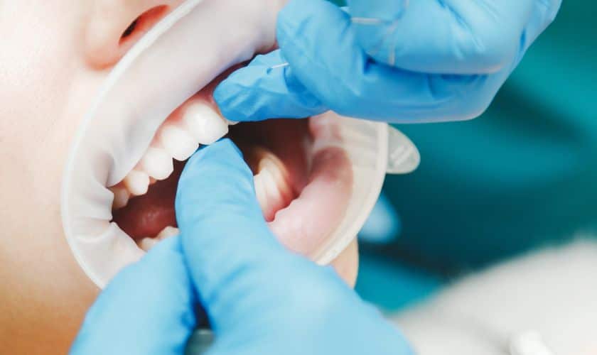 Gum Disease Treatment