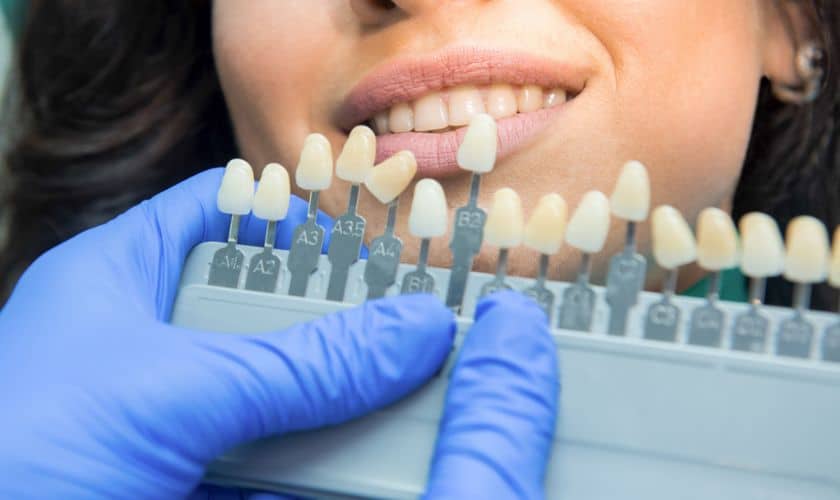 Teeth Whitening