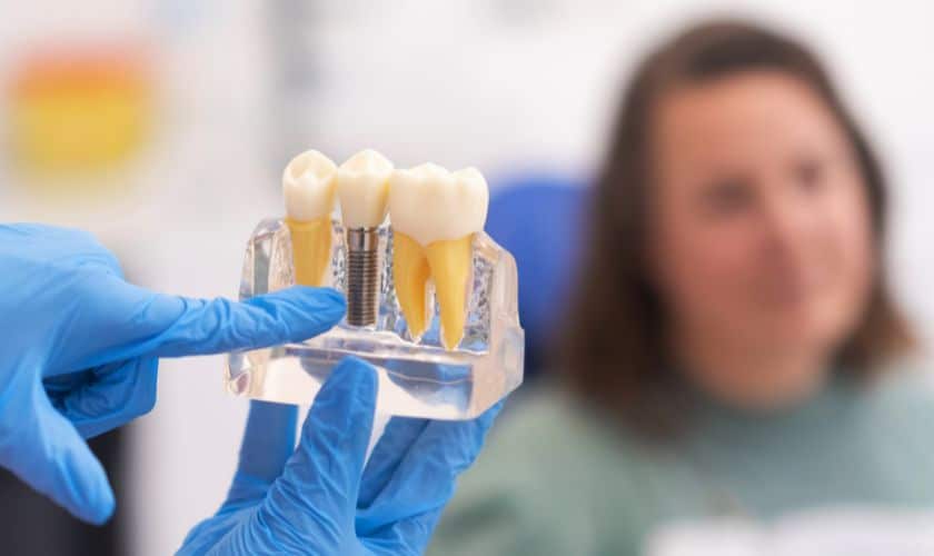 Dental Implants in Fayetteville