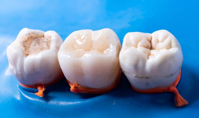 diseases cause rapid tooth decay