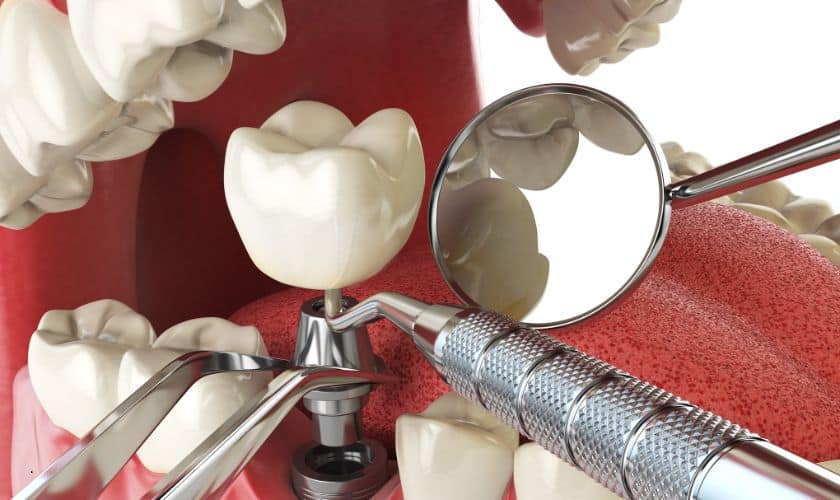 Dental instruments and tooth models displayed on red surface for examination and treatment planning.