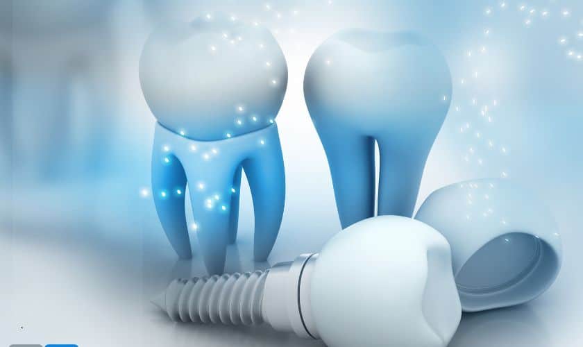 difference between a dental post and implant