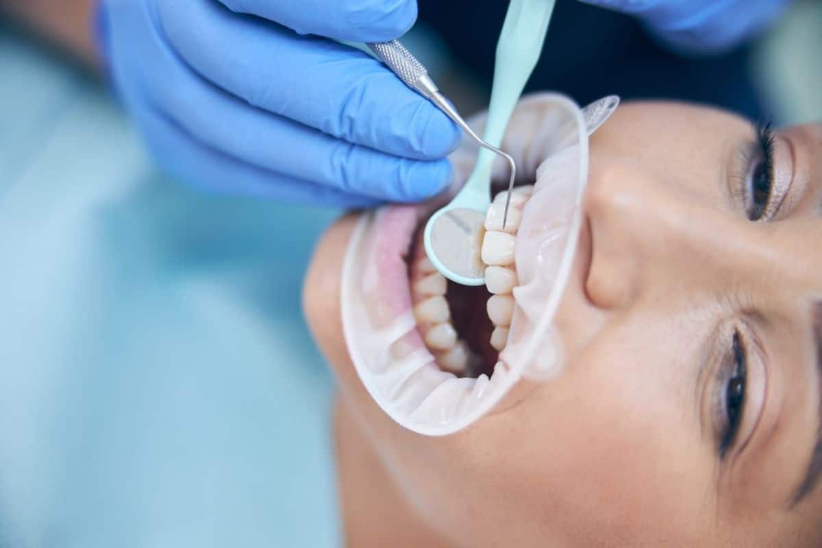 Dentist in blue gloves examining patient's teeth during dental checkup at clinic.