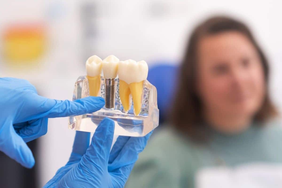 Dental professional in blue gloves holding dental implant model for patient consultation.