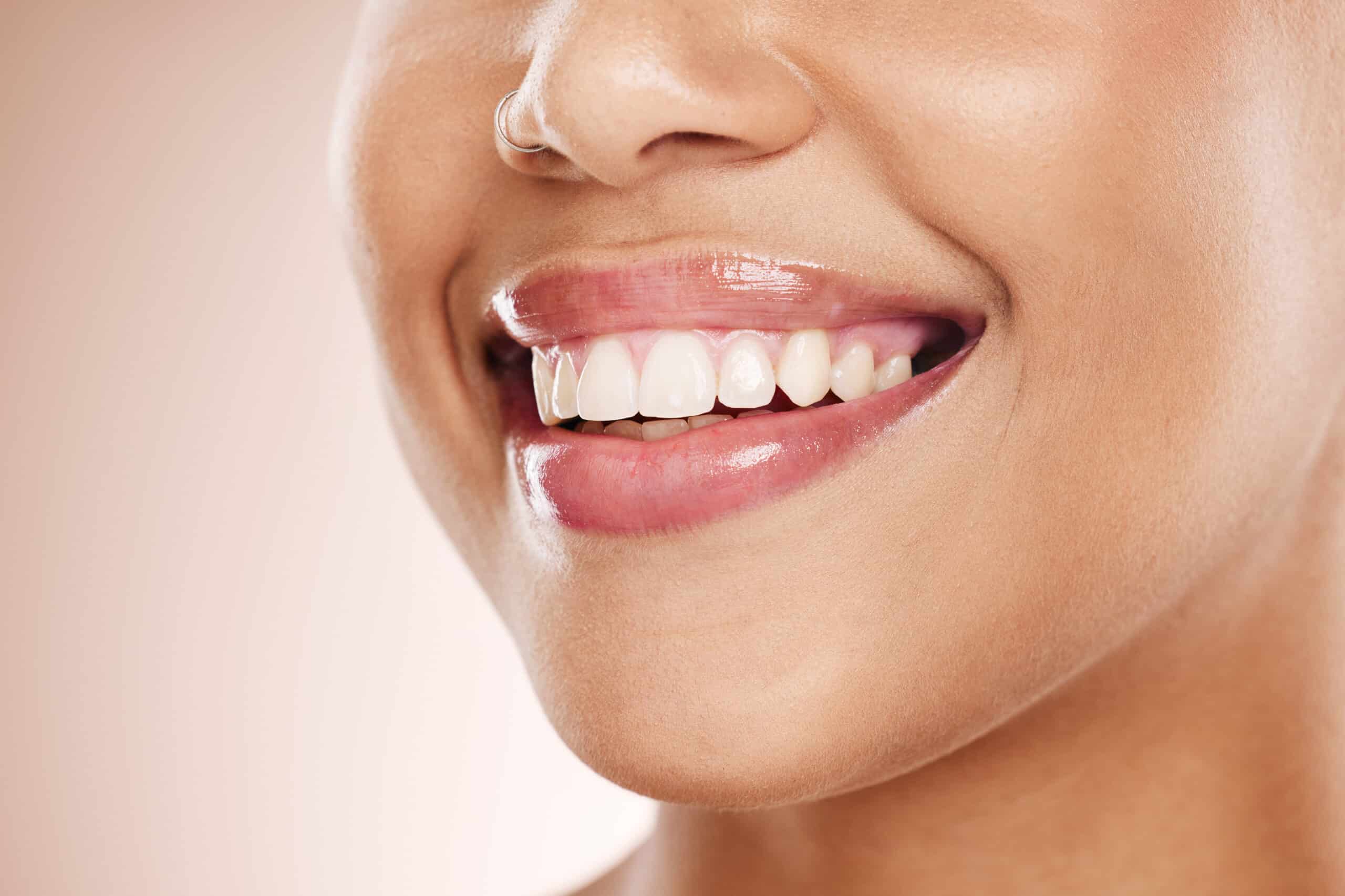 Close-up of woman's smile showing white teeth and healthy gums against neutral background.
